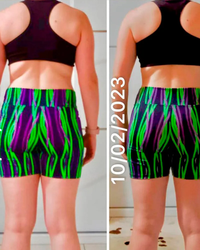 Antes e depois — Ana Cláudia