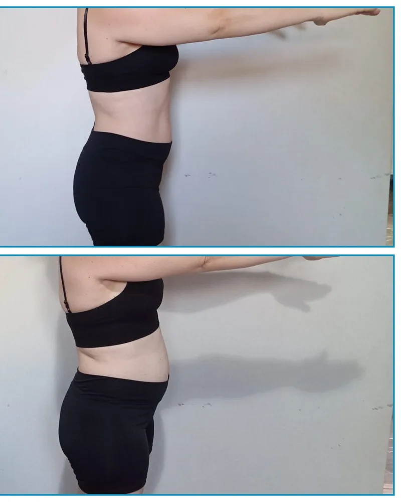 Antes e depois — Lizete