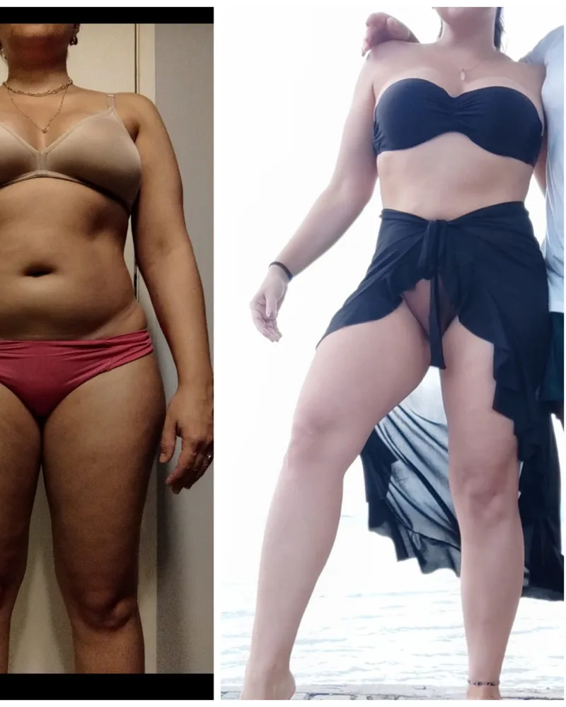 Antes e depois — Wisley
